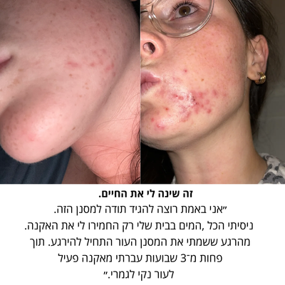 זֶרֶם ידית מסננת למקלחת