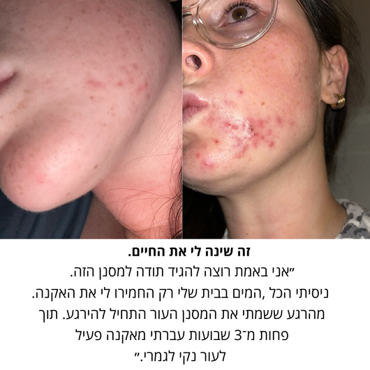 זֶרֶם ידית מסננת למקלחת